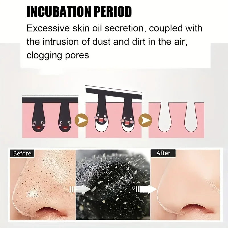 15pcs Blackhead Nose Strips Deep Cleansing Nasal Spot Facial